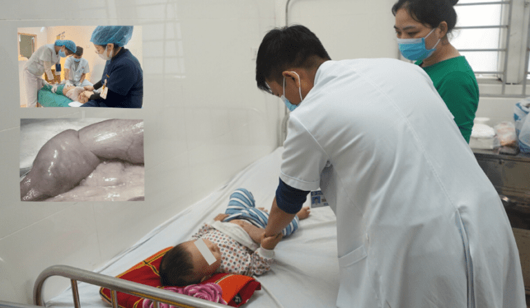 Thời tiết thay đổi, gia tăng tình trạng trẻ mắc bệnh lồng ruột