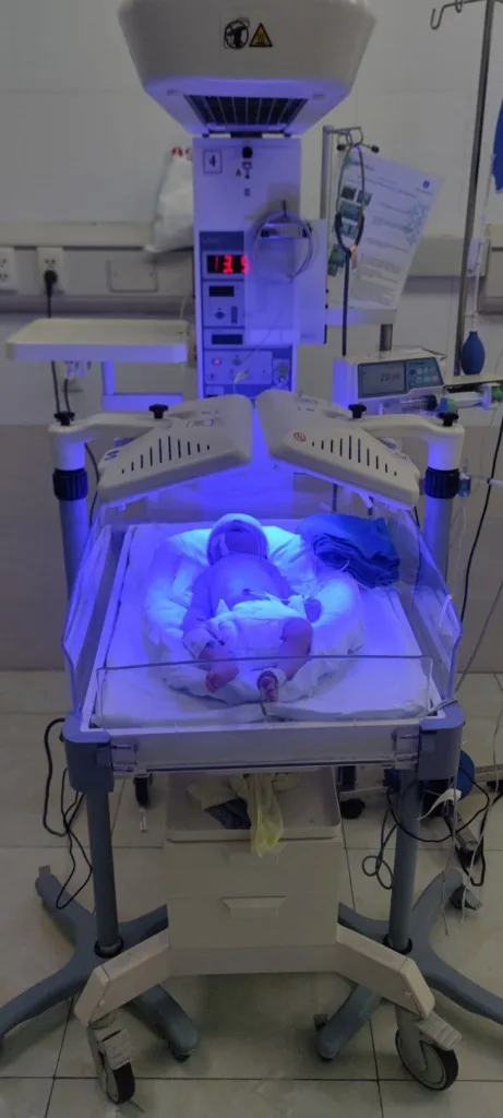 Bất đồng nhóm máu với mẹ, bé sơ sinh vàng da nặng, phải thay máu
