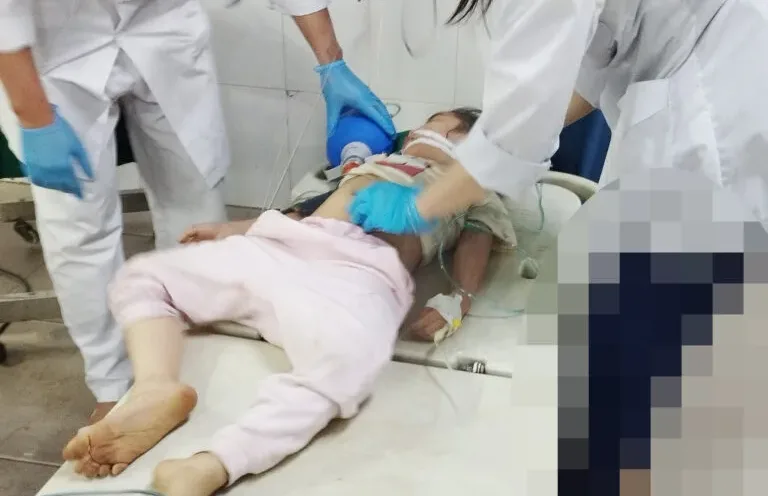 Bé gái 5 tuổi bị suy hô hấp nặng do hóc quả nhãn
